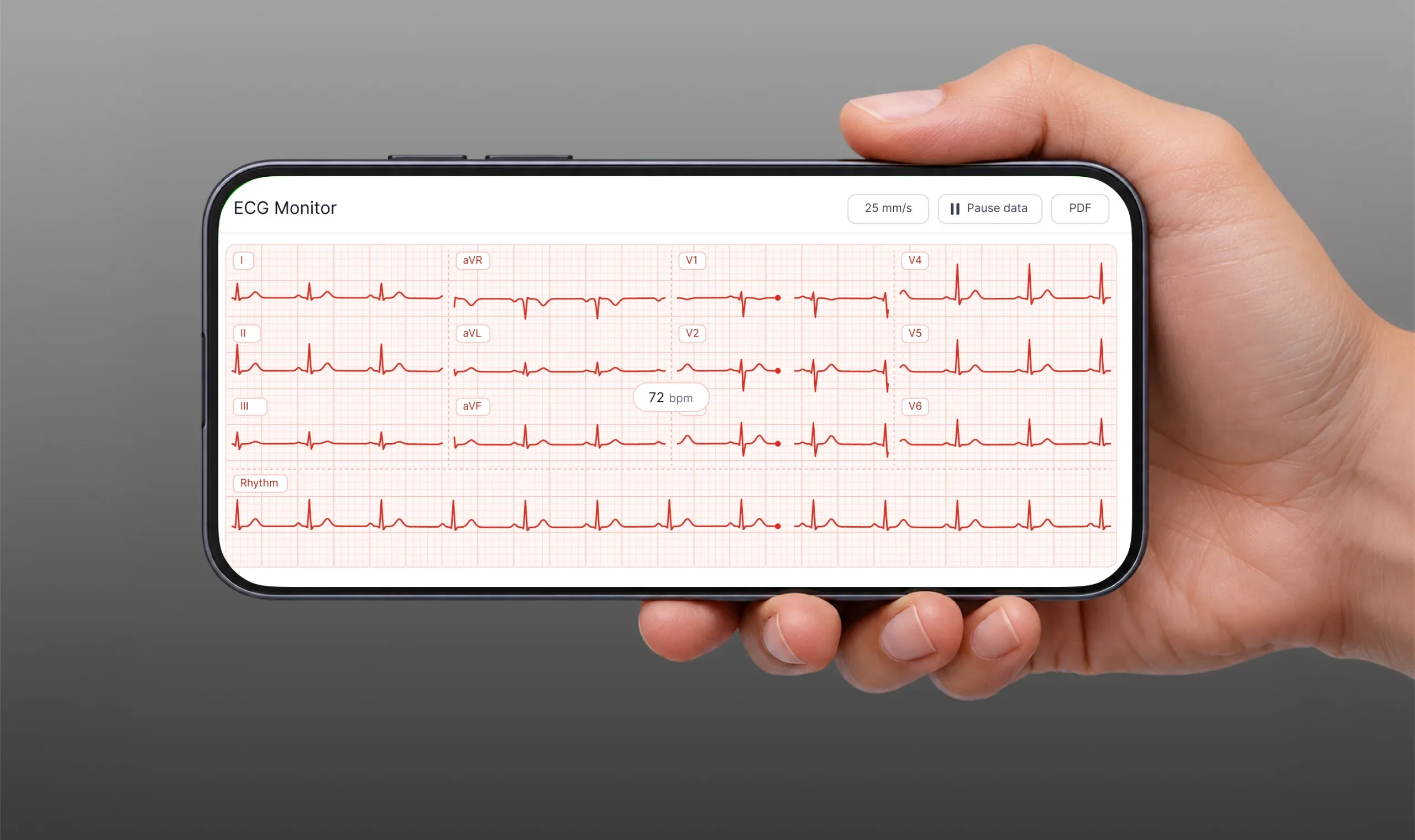 A smartphone screen shows multi-lead ECG readings and a continuous rhythm trace.