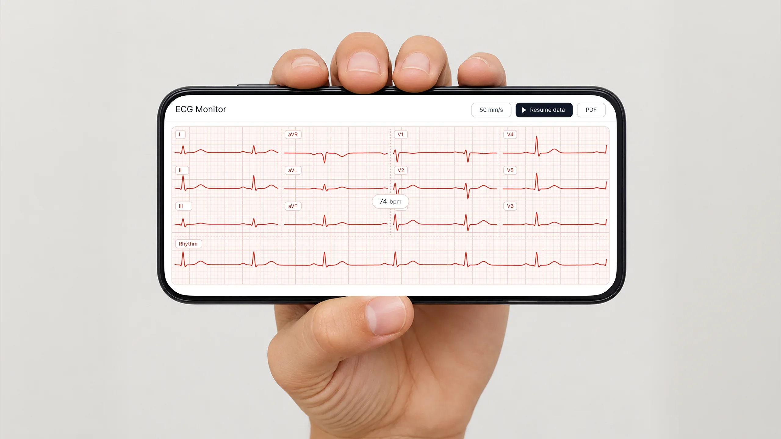 A hand holds a phone showing paused multi-lead ECG readings at 74 bpm.