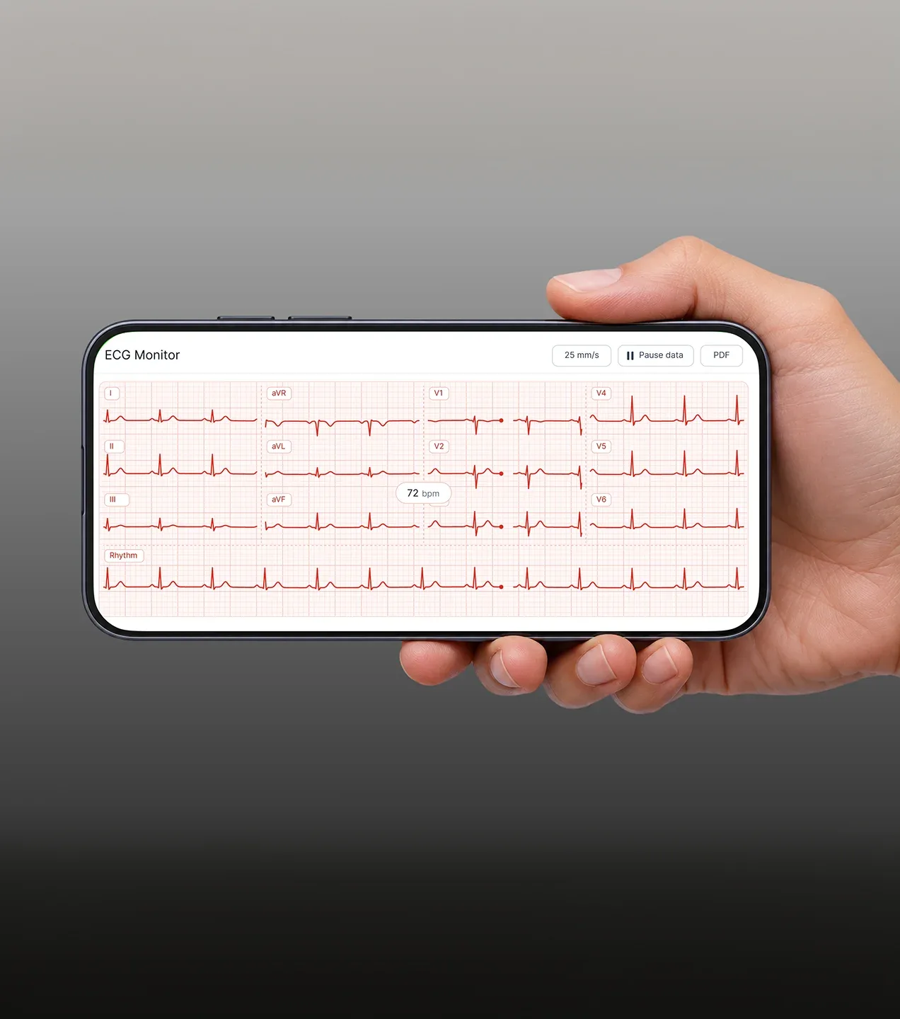 Portable ECG Monitoring App