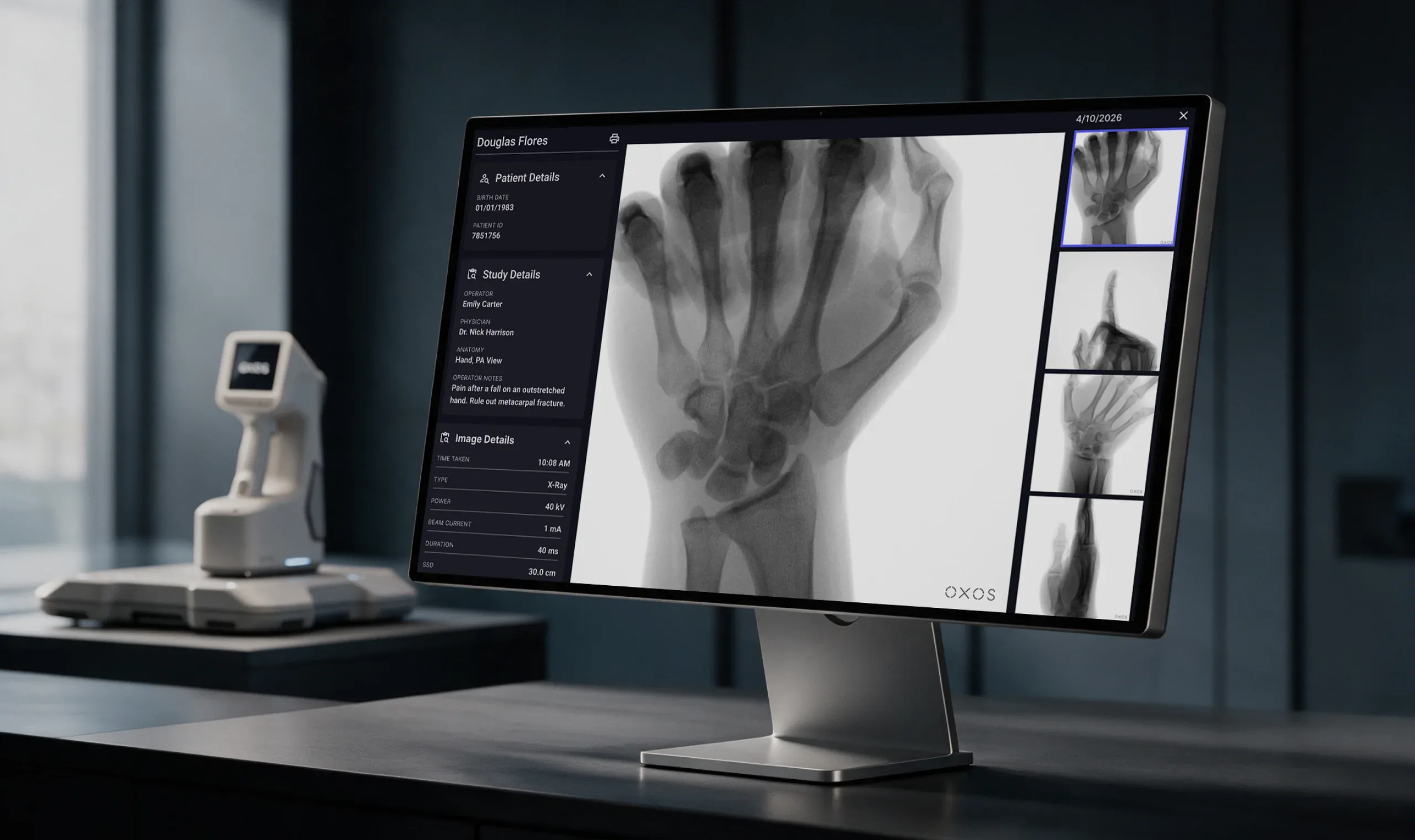 Radiology workstation showing a hand X-ray, patient and study details, and additional image views.