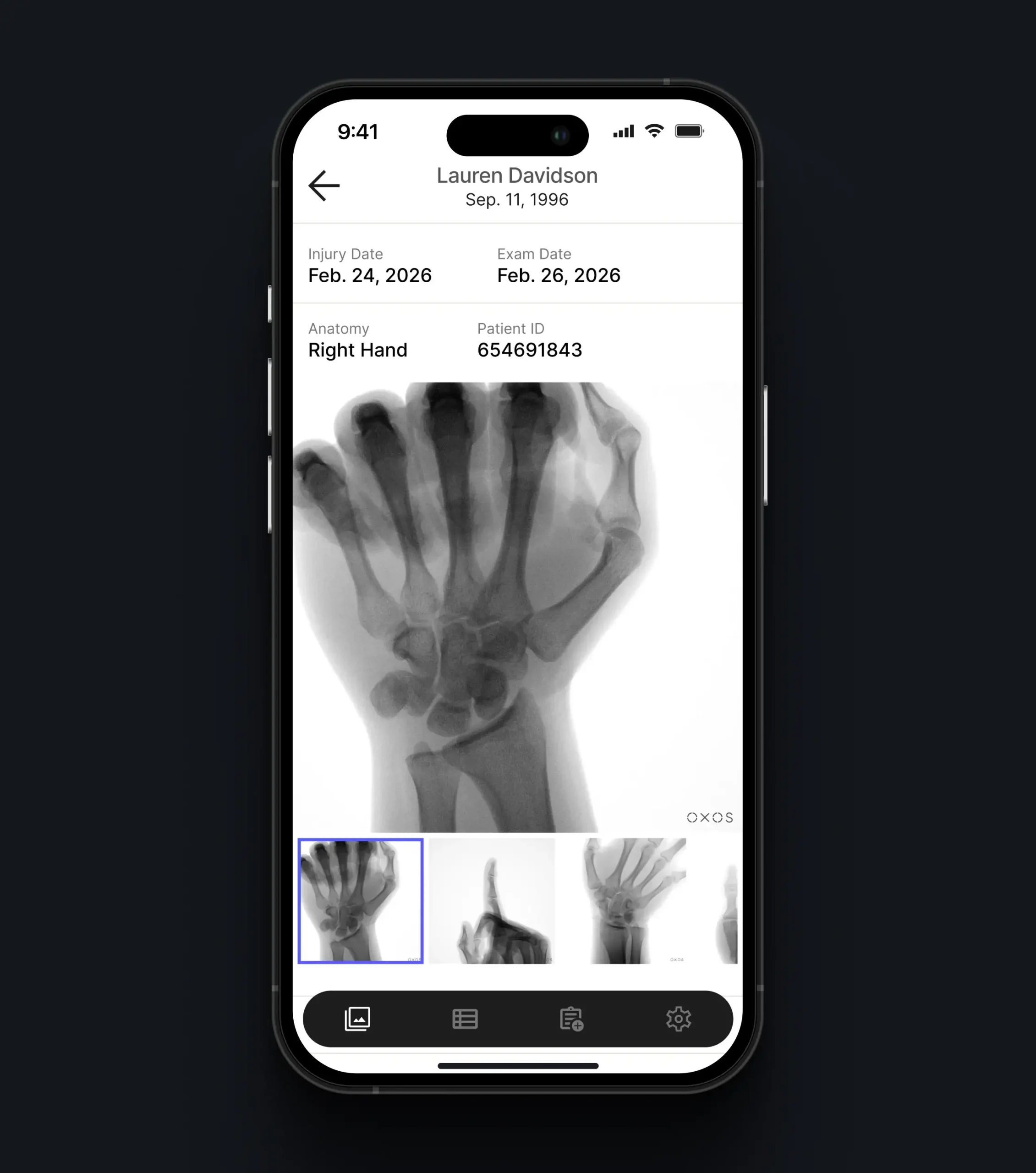 Mobile X-ray viewer showing exam details, a hand radiograph, related images, and navigation controls.