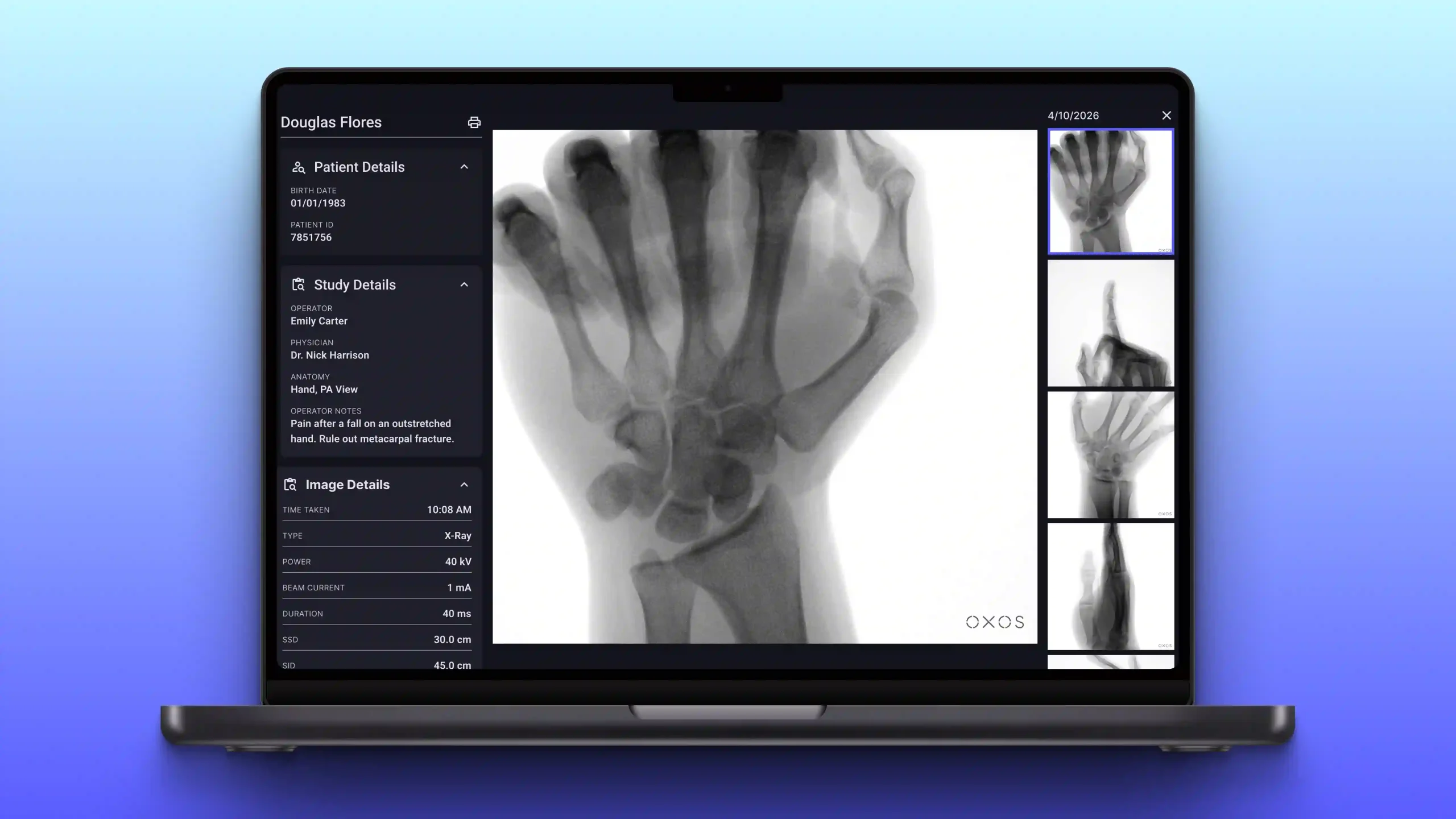 Laptop displaying a hand X-ray with patient details and a column of related radiographs.