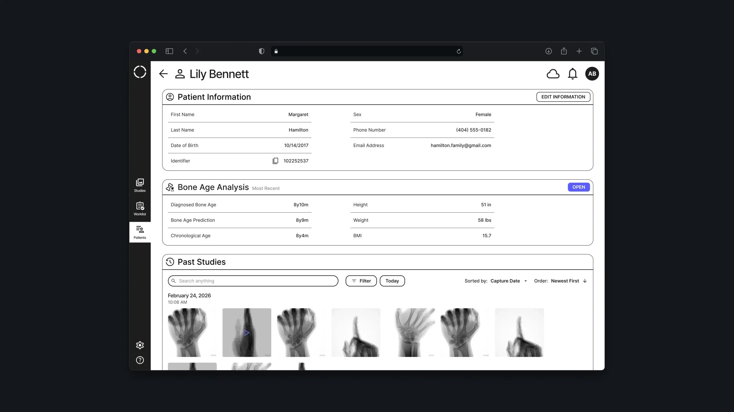 Patient profile with bone age results and a gallery of previous X-ray studies.