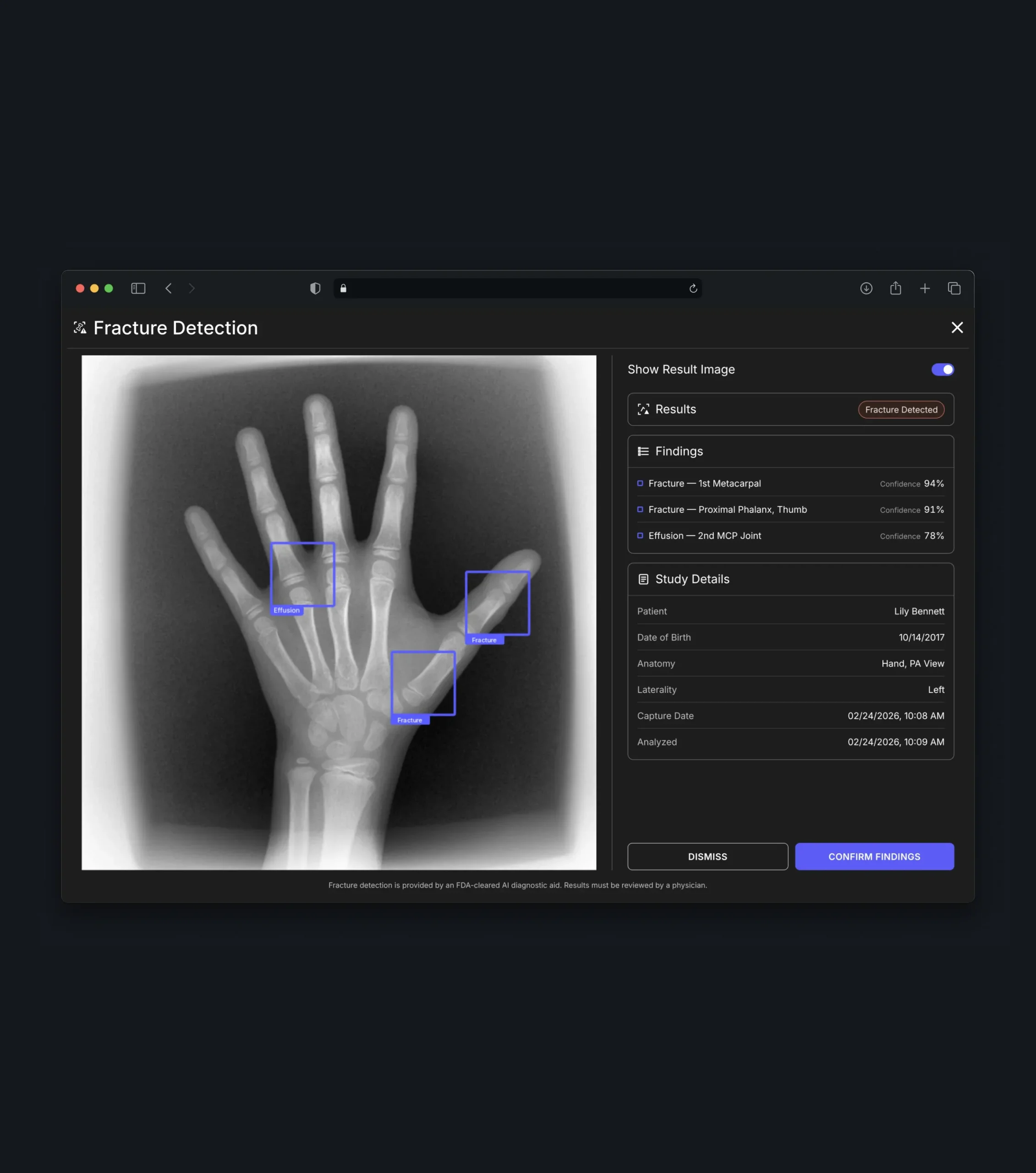 Fracture detection screen highlighting findings on a hand X-ray beside study details.