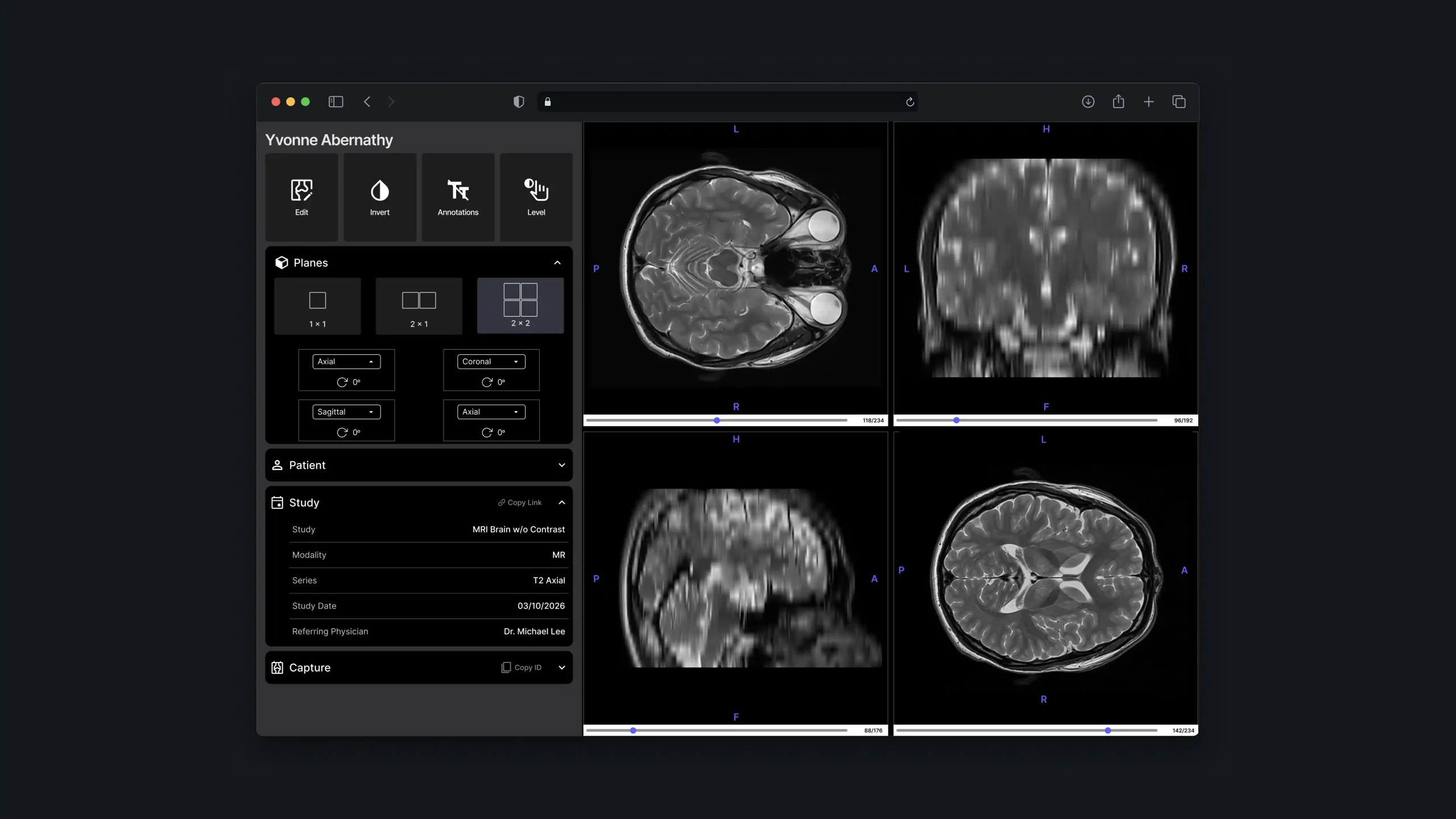 Medical image viewer displaying four brain MRI views with plane controls and study details.